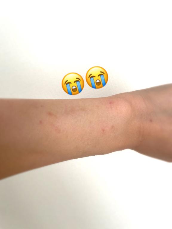 宿命😭